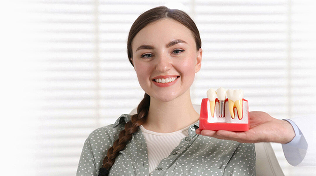 Navigating Tooth Replacement: Dental Implants and Beyond